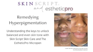 ASCP Editorial and Microneedling Love Blog featured image