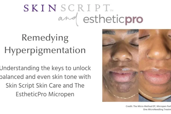 ASCP Editorial and Microneedling Love Blog featured image